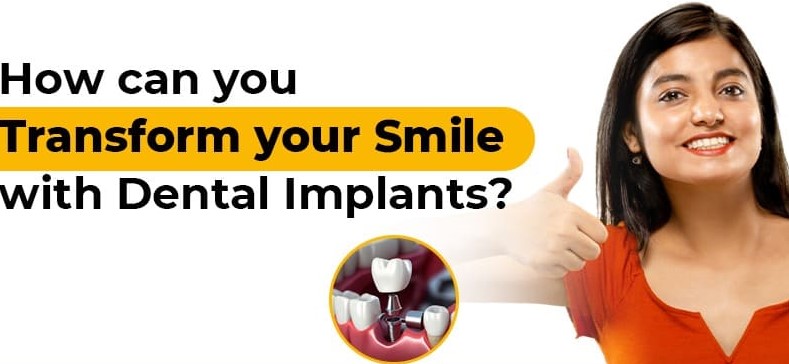 How can you transform your smile with dental implants?