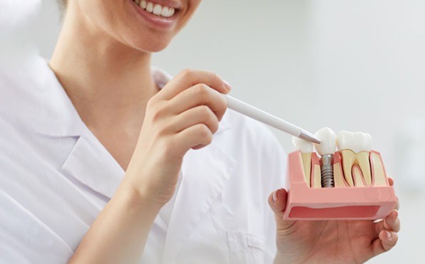 What is the difference between a before and post-dental implant?